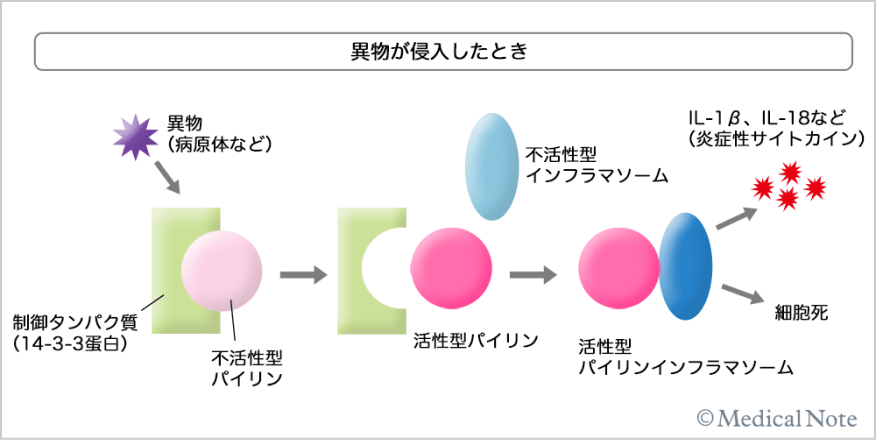 異物が混入したとき
