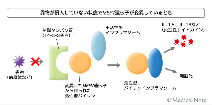 異物が混入していない状態でMEFV遺伝子が異変しているとき