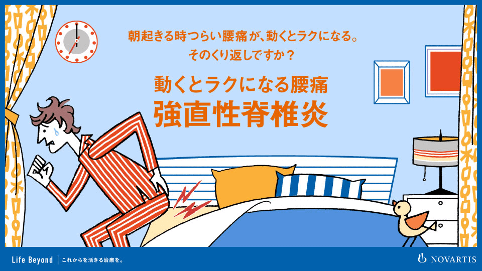 強直性脊椎炎を診断できる検査は何ですか?